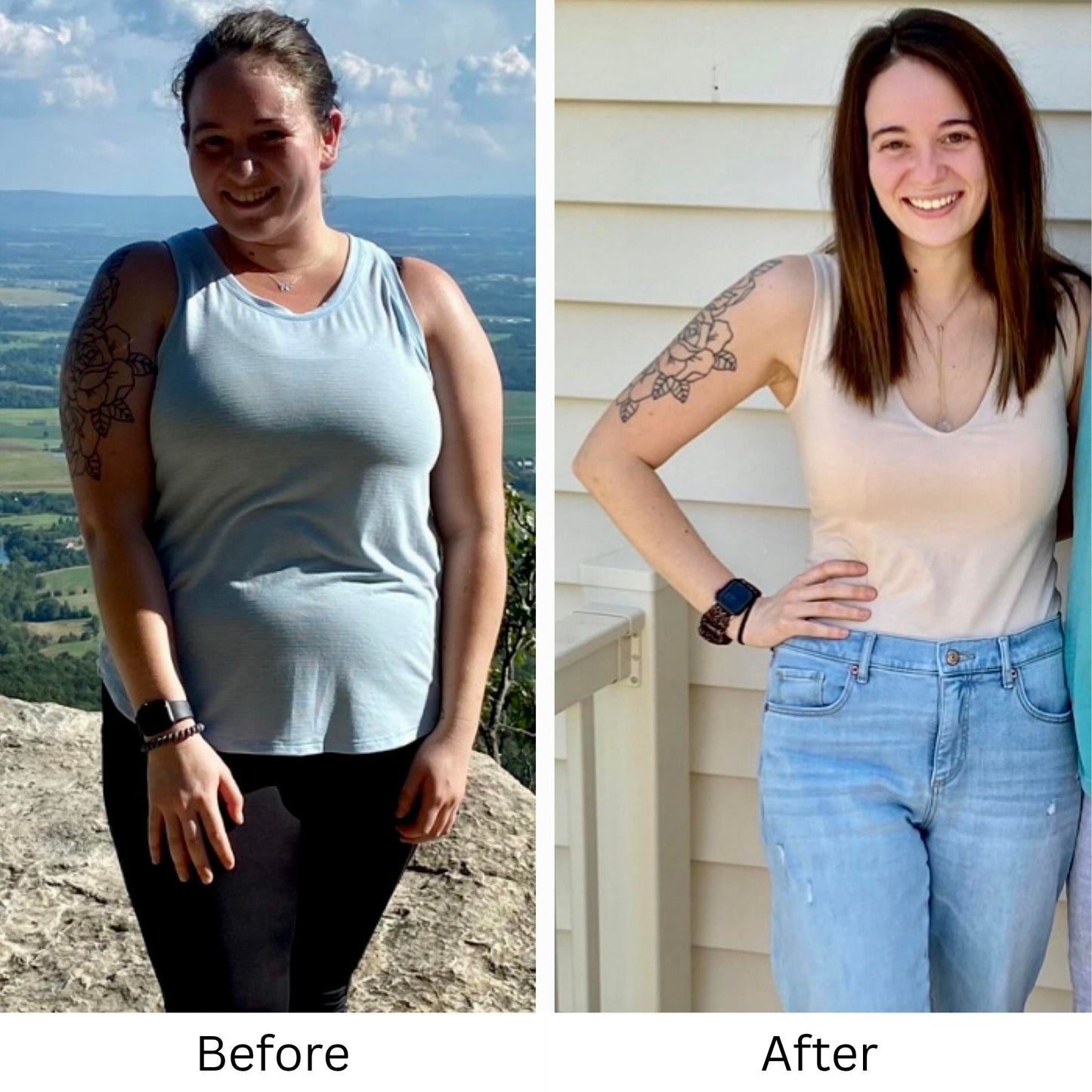 GLP - 1 Patches - Weight Management - Vitality Plus