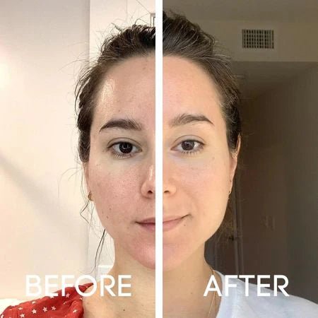 Dr.Melaxin Peel Shot Exfoliant Rice Ampoule Duo Set - Vitality Plus