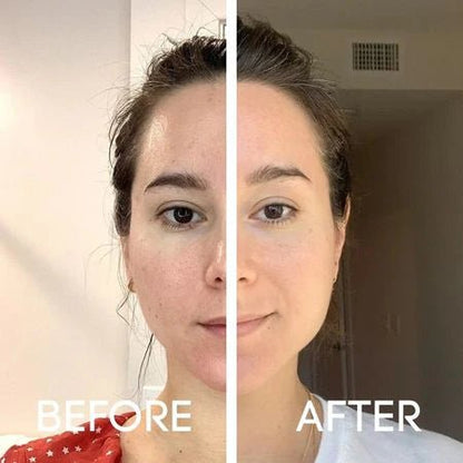 Dr.Melaxin Peel Shot Exfoliant Rice Ampoule Duo Set - Vitality Plus