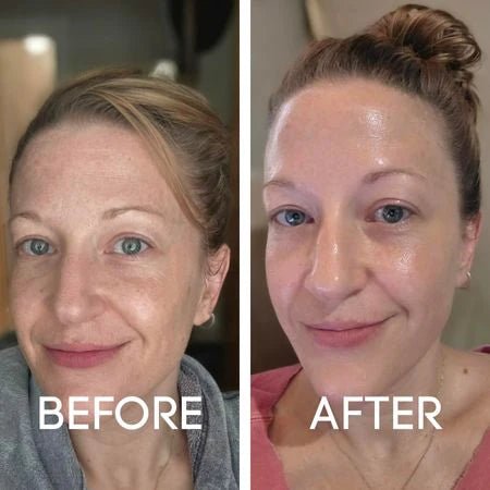 Dr.Melaxin Peel Shot Exfoliant Rice Ampoule Duo Set - Vitality Plus