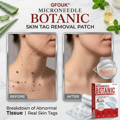 Microneedle Botanic Removal Patch - Vitality Plus