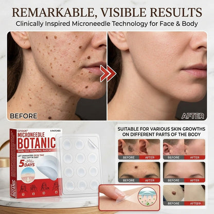 Microneedle Botanic Removal Patch - Vitality Plus