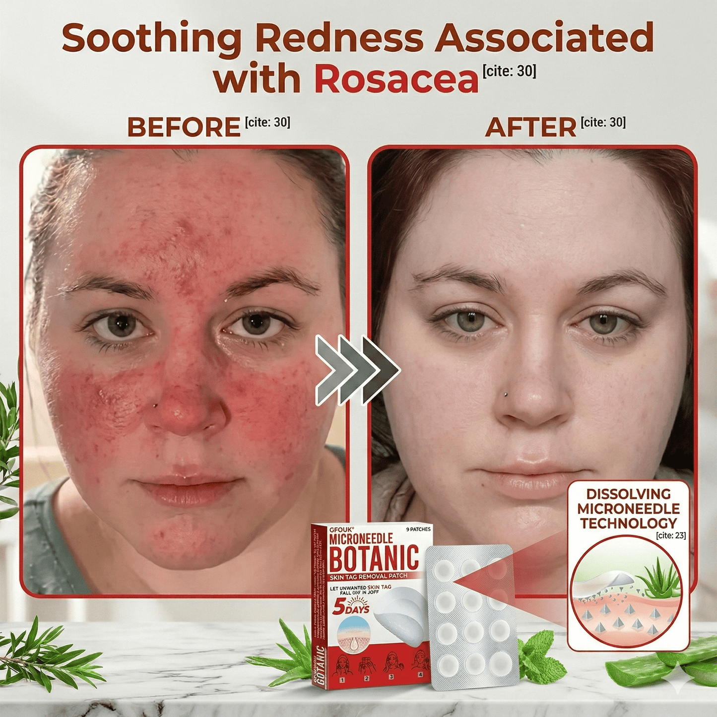 Microneedle Botanic Removal Patch - Vitality Plus