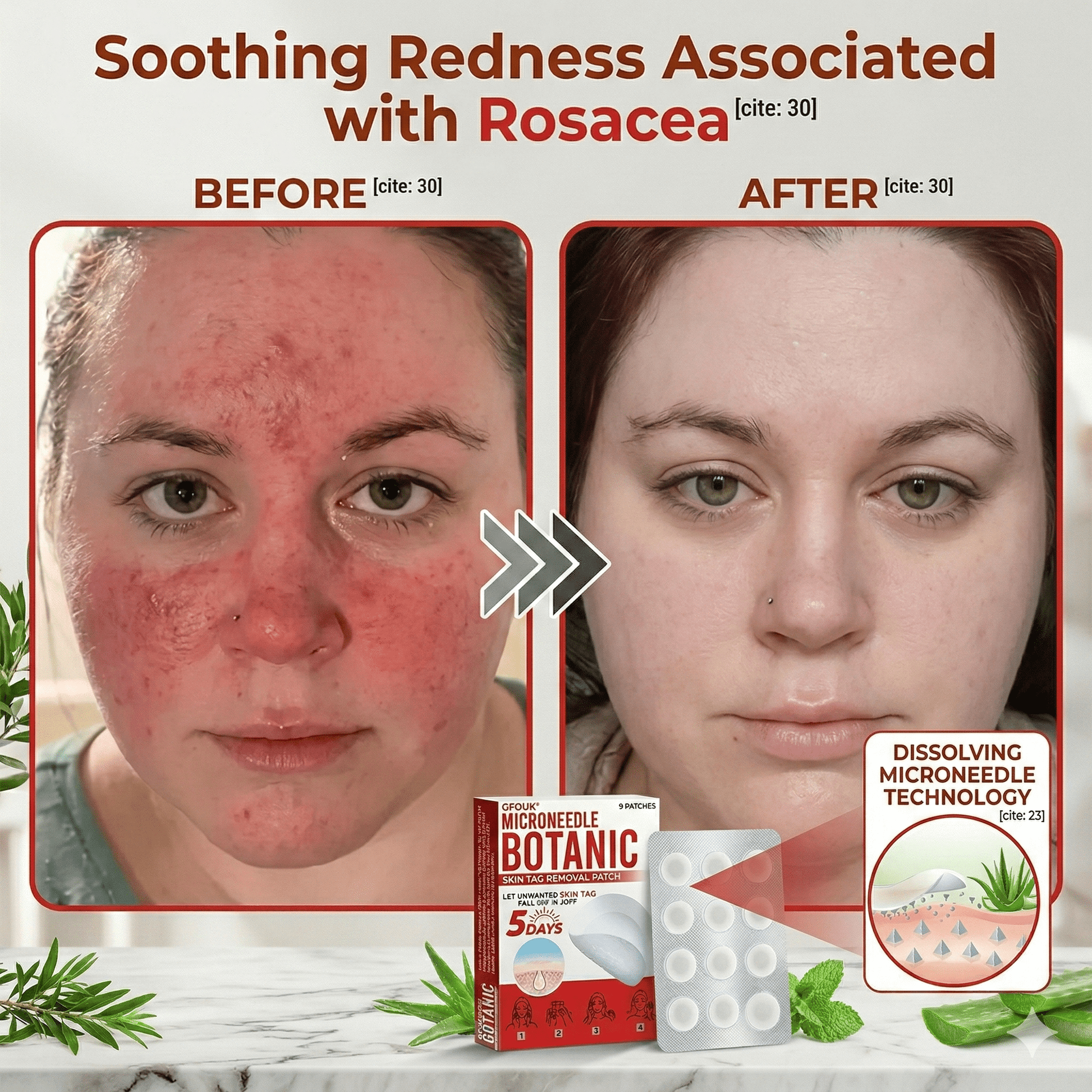 Microneedle Botanic Removal Patch - Vitality Plus